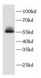 Coronin 1A antibody, FNab01882, FineTest, Western Blot image 