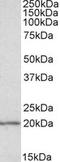 Eukaryotic Translation Initiation Factor 5A antibody, TA305785, Origene, Western Blot image 