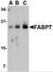 Fatty Acid Binding Protein 7 antibody, 4259, ProSci, Western Blot image 