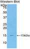 T-Box 3 antibody, LS-C296583, Lifespan Biosciences, Western Blot image 