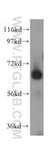 Carboxyl Ester Lipase antibody, 15384-1-AP, Proteintech Group, Western Blot image 