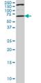 Uridine-Cytidine Kinase 1 Like 1 antibody, H00054963-M01, Novus Biologicals, Western Blot image 