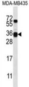 Casein Beta antibody, abx026951, Abbexa, Western Blot image 
