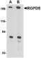 RANBP2 Like And GRIP Domain Containing 6 antibody, LS-C53293, Lifespan Biosciences, Western Blot image 