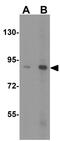 PPARG Coactivator 1 Alpha antibody, GTX31910, GeneTex, Western Blot image 