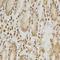 Histone Deacetylase 6 antibody, LS-C746968, Lifespan Biosciences, Immunohistochemistry frozen image 
