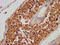 Thyroglobulin antibody, LS-C394730, Lifespan Biosciences, Immunohistochemistry paraffin image 