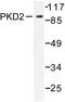 Protein Kinase D2 antibody, LS-C176459, Lifespan Biosciences, Western Blot image 