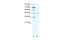 Gamma-Aminobutyric Acid Type A Receptor Alpha2 Subunit antibody, 31-102, ProSci, Western Blot image 