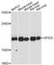 Vacuolar Protein Sorting 25 Homolog antibody, LS-C748195, Lifespan Biosciences, Western Blot image 