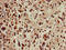 Telomeric Repeat Binding Factor 1 antibody, LS-C682263, Lifespan Biosciences, Immunohistochemistry paraffin image 