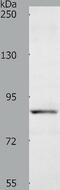 Acyl-CoA Dehydrogenase Family Member 11 antibody, TA322145, Origene, Western Blot image 