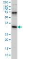N-Methylpurine DNA Glycosylase antibody, H00004350-M08, Novus Biologicals, Western Blot image 