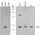 Superoxide Dismutase 2 antibody, MAB3419, R&D Systems, Western Blot image 