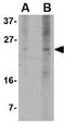BCL2 Binding Component 3 antibody, GTX84990, GeneTex, Western Blot image 