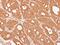 Catenin Alpha 3 antibody, NBP2-16030, Novus Biologicals, Immunohistochemistry paraffin image 