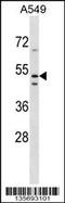 Transmembrane Protein 200A antibody, 58-389, ProSci, Western Blot image 