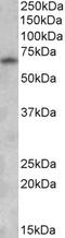 Glutamate Decarboxylase 1 antibody, STJ71805, St John