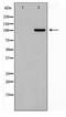 G Protein Regulated Inducer Of Neurite Outgrowth 1 antibody, TA347728, Origene, Western Blot image 