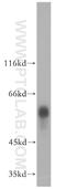 GC Vitamin D Binding Protein antibody, 16922-1-AP, Proteintech Group, Western Blot image 