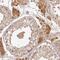 T-cell leukemia/lymphoma protein 1B antibody, PA5-62747, Invitrogen Antibodies, Immunohistochemistry paraffin image 