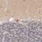 Thioredoxin Like 1 antibody, NBP1-86899, Novus Biologicals, Immunohistochemistry paraffin image 