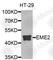 Essential Meiotic Structure-Specific Endonuclease Subunit 2 antibody, A9891, ABclonal Technology, Western Blot image 