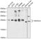 Mitotic Arrest Deficient 2 Like 2 antibody, 14-507, ProSci, Western Blot image 