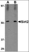 Sirtuin 1 antibody, orb88751, Biorbyt, Western Blot image 