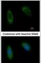 Translocating chain-associated membrane protein 1 antibody, PA5-21955, Invitrogen Antibodies, Immunofluorescence image 