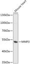 Matrix Metallopeptidase 3 antibody, GTX55709, GeneTex, Western Blot image 