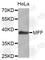 Mitochondrial Fission Factor antibody, A4874, ABclonal Technology, Western Blot image 