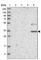 Regucalcin antibody, HPA029102, Atlas Antibodies, Western Blot image 