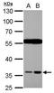 HtrA Serine Peptidase 2 antibody, PA5-29182, Invitrogen Antibodies, Western Blot image 