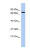 SNF-related serine/threonine-protein kinase antibody, NBP1-54944, Novus Biologicals, Western Blot image 