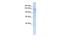 Interphotoreceptor Matrix Proteoglycan 2 antibody, GTX46342, GeneTex, Western Blot image 