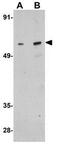 RUNX Family Transcription Factor 1 antibody, GTX31789, GeneTex, Western Blot image 