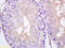 Sperm Associated Antigen 5 antibody, 250866, Abbiotec, Immunohistochemistry paraffin image 