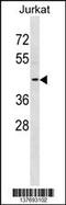 Potassium Voltage-Gated Channel Subfamily A Regulatory Beta Subunit 3 antibody, 59-918, ProSci, Western Blot image 