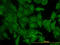 KRAS Proto-Oncogene, GTPase antibody, LS-C197585, Lifespan Biosciences, Immunofluorescence image 