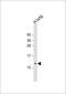 Putative protein RIG antibody, MBS9216962, MyBioSource, Western Blot image 