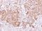 Bone morphogenetic protein 15 antibody, GTX110245, GeneTex, Immunohistochemistry paraffin image 