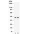 Adenosine Deaminase antibody, R32414, NSJ Bioreagents, Western Blot image 