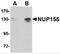 Nucleoporin 155 antibody, 4703, ProSci, Western Blot image 