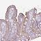 Plastin 1 antibody, NBP2-30592, Novus Biologicals, Immunohistochemistry paraffin image 
