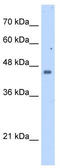 Farnesyl-Diphosphate Farnesyltransferase 1 antibody, TA346722, Origene, Western Blot image 