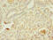 Alpha-2-Glycoprotein 1, Zinc-Binding antibody, CSB-PA11039A0Rb, Cusabio, Immunohistochemistry paraffin image 