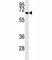 Matrix Metallopeptidase 2 antibody, F53512-0.1ML, NSJ Bioreagents, Western Blot image 