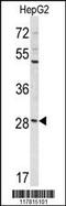 Coiled-Coil Domain Containing 85B antibody, MBS9210923, MyBioSource, Western Blot image 