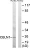 Cerebellin 1 Precursor antibody, TA312954, Origene, Western Blot image 